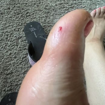 Professional Nails and Spa - Hurt toe - Day Spas Near Me - San Clemente, California Professional Nails and Spa - Hurt toe - Day Spas Near Me - San Clemente, California