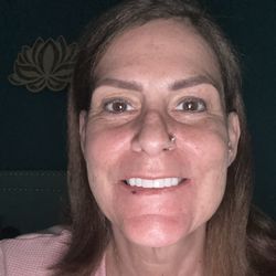 Kevin Shim,DDS - Premier Dentistry - Permanent ceramic crowns, they're beautiful