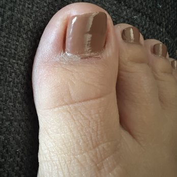 Princess Nails - They buffed the skin below my cuticle - Nail Salons Near Me - Long Beach, California Princess Nails - They buffed the skin below my cuticle - Nail Salons Near Me - Long Beach, California