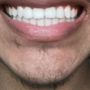 Photo of Eagle Rock Smile