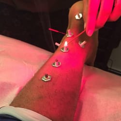 Healthy Mind and Body Acupuncture - Moxa