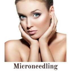 The Med Spa of North Texas - Fractional Microneedling with Radio Frequency In Allen, TX.