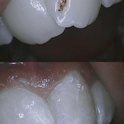 Milpitas Smile Design