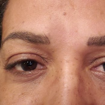 A Better Image - Hair Removal Near Me - Glastonbury, Connecticut