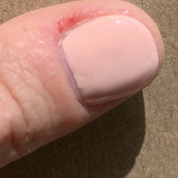 Tibet nails & Spa - Here you can see where they caused my finger to bleed after being extremely hasty and rough - Nail Salons Near Me - New York, New York Tibet nails & Spa - Here you can see where they caused my finger to bleed after being extremely hasty and rough - Nail Salons Near Me - New York, New York
