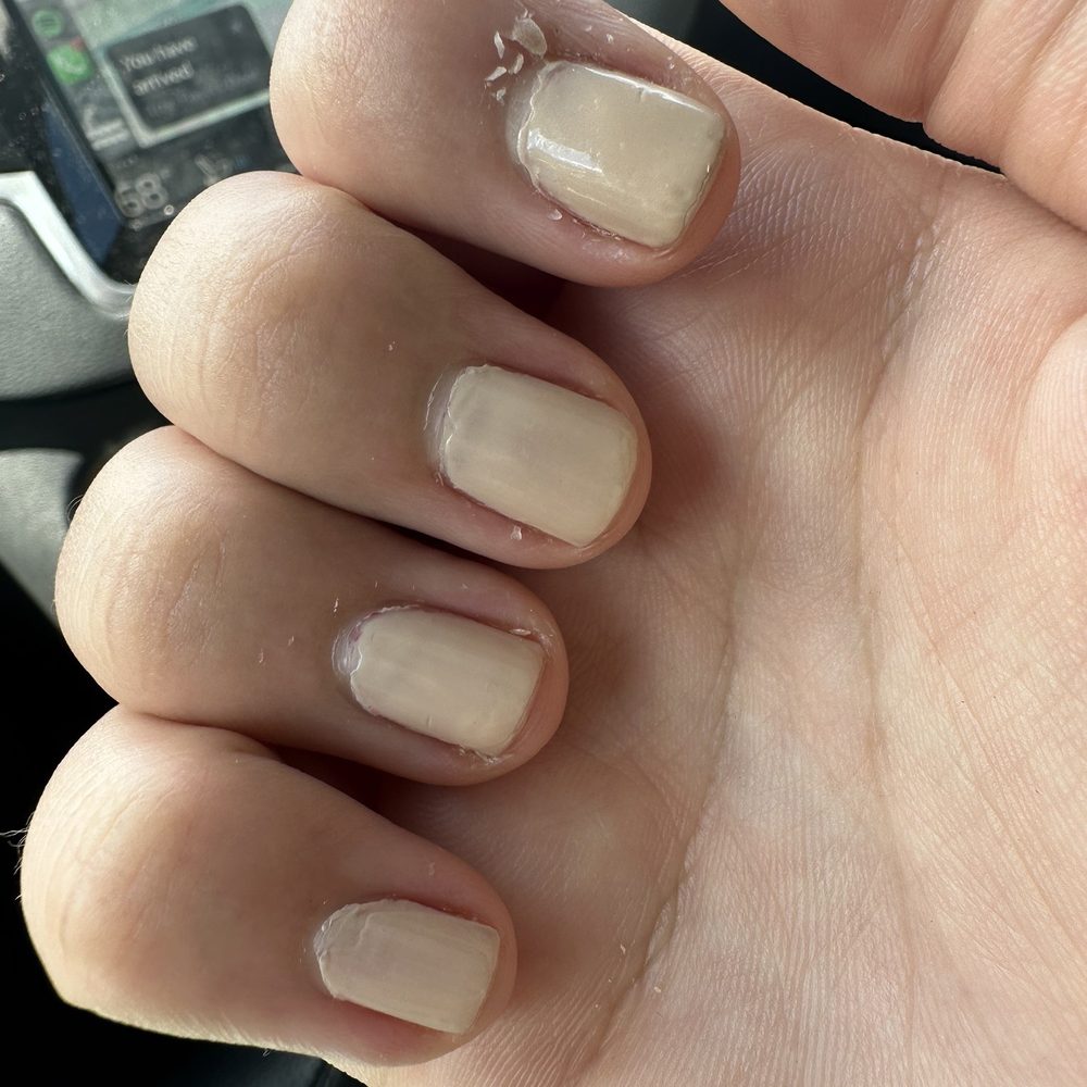 Cuticles and uneven edges