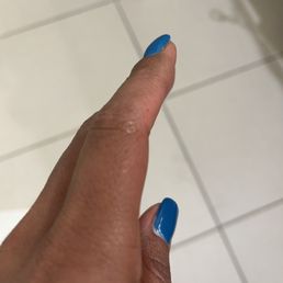 From the removal of my tips.