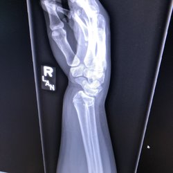 Jon Norberg, MD - Wrist Fracture