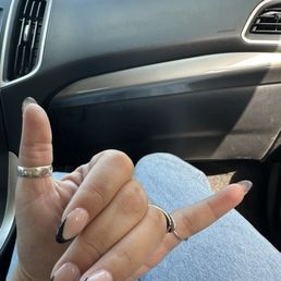 Look at the length difference in my thumb nail and pinky nail..... Look at the length difference in my thumb nail and pinky nail.....