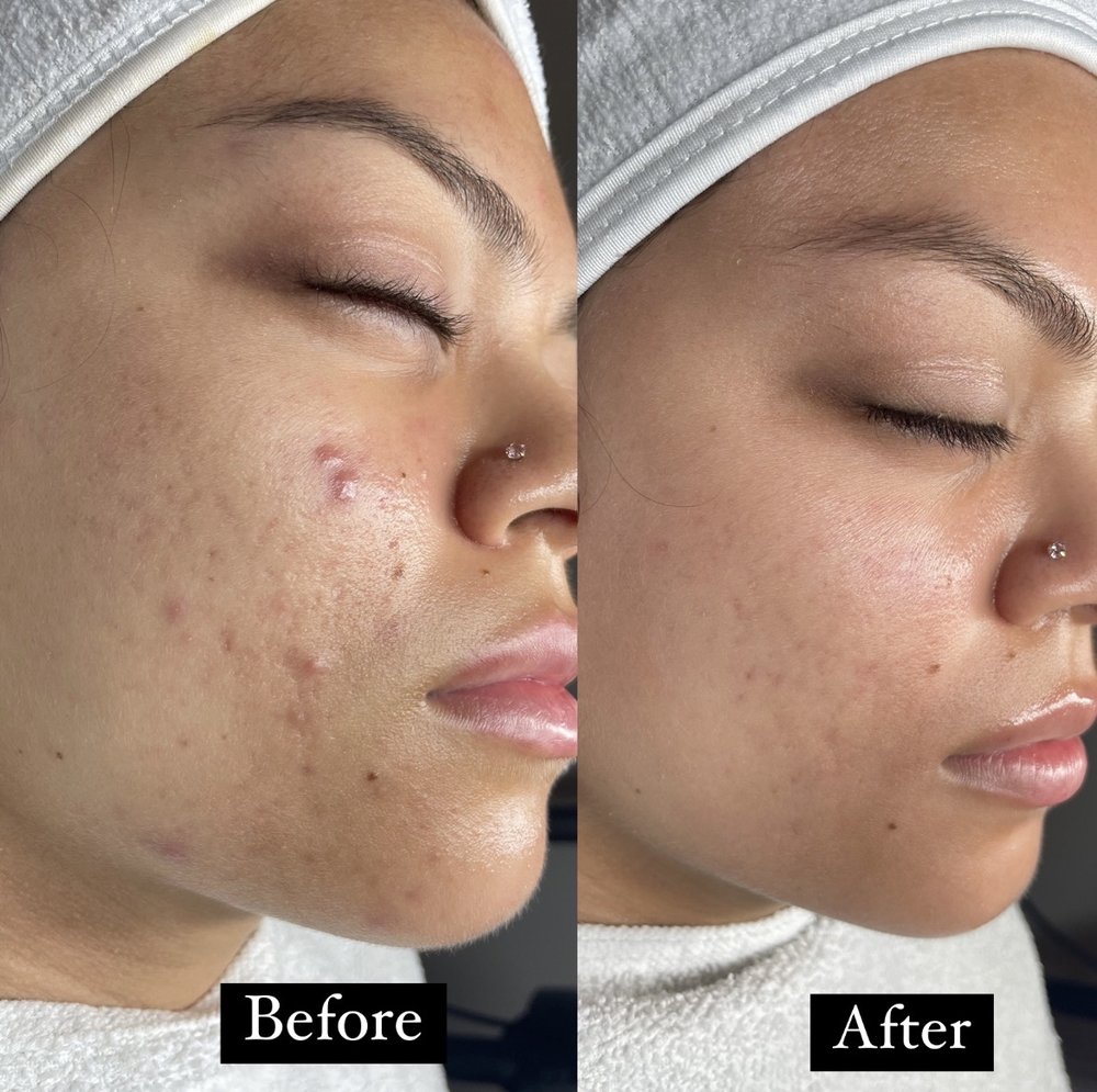 Traes Skin studio Logo