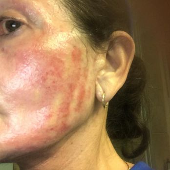 Miguel Delgado, M.D - Oct 2018 - Cosmetic Surgeons Near Me - Novato, California Miguel Delgado, M.D - Oct 2018 - Cosmetic Surgeons Near Me - Novato, California