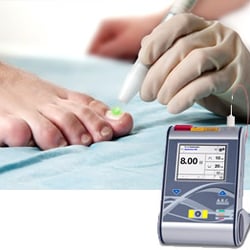 Alexandria Family Podiatry - We offer Laser Treatment for Toenail Fungus. Painless, no side effects, and effective.