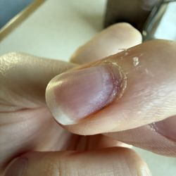 A Plus Nails - Damage from electronic file pressing too hard