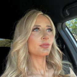 Robinson Facial Plastic Surgery - This is just after two weeks! Thank you