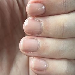 Poorly done gel nails.