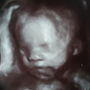 Unique Ultrasound - Picture perfect. Finally let herself be seen!! - Diagnostic Imaging Near Me - Temecula, California Unique Ultrasound - Picture perfect. Finally let herself be seen!! - Diagnostic Imaging Near Me - Temecula, California
