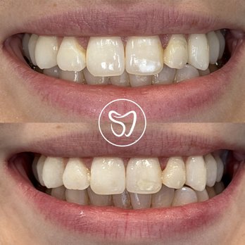 Supreme Dental - General Dentistry Near Me - Las Vegas, Nevada Supreme Dental - General Dentistry Near Me - Las Vegas, Nevada
