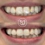Supreme Dental