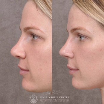 Ben Talei, MD - Cosmetic Surgeons Near Me - Beverly Hills, California