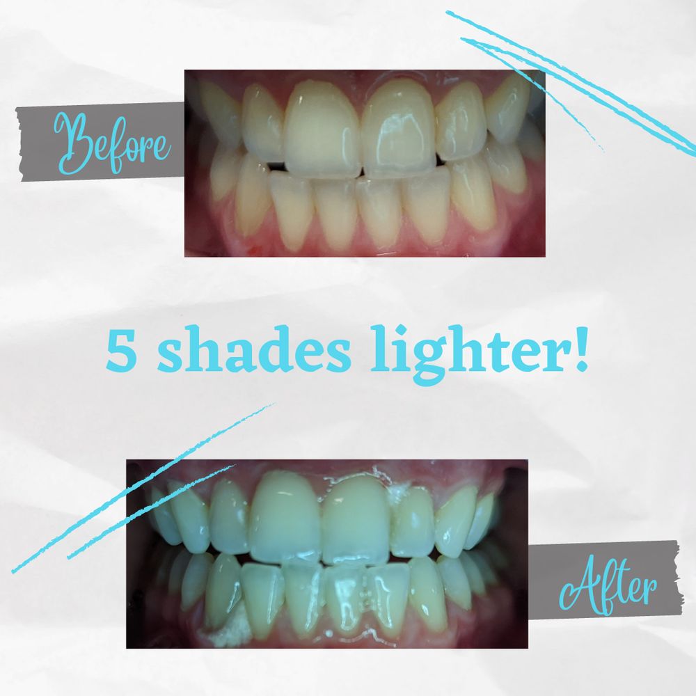 Smile N Bliss Teeth Whitening Logo