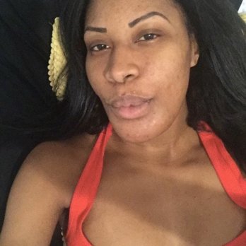 Weston Center for Plastic Surgery - Look at my chin!!!! 1 year post op. Does this make sense to you? - Medical Spas Near Me - Weston, Florida Weston Center for Plastic Surgery - Look at my chin!!!! 1 year post op. Does this make sense to you? - Medical Spas Near Me - Weston, Florida