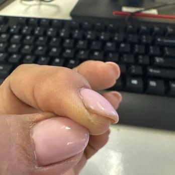 Glamour Nails - Ingrown and dead skin remain a brought despite I said cleannnnnnnnnn it first ay karamba - Nail Salons Near Me - Cerritos, California