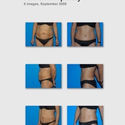 Sanjay Sharma, MD - Plastic Surgery Austin - Body Contouring