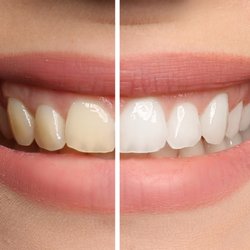 Dental Health Group