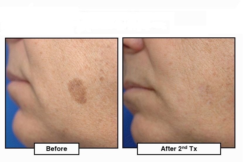 MEDLASER Updated September 2024 14 Photos 2042 Central Park Ave