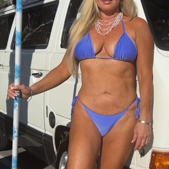 Michael Grossman, MD - 6 weeks after my first cool sculpting treatment - Medical Spas Near Me - Newport Beach, California