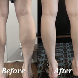 Venus Cosmetic Med Spa - By nurse Seyeon