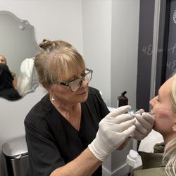 4Ever Young Med Spa & Wellness Center - Boca Raton - Juvederm Fillers 4Ever Young Med Spa Boca Raton
