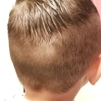 Family Cuts - Bald spot. - Waxing Near Me - San Antonio, Texas Family Cuts - Bald spot. - Waxing Near Me - San Antonio, Texas