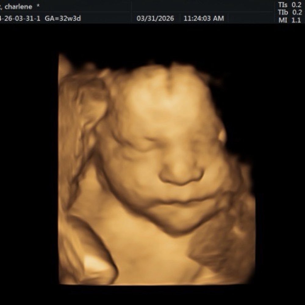 Baby’s First Glance - Ultrasound Imaging Centers Near Me - San Jose, California Baby’s First Glance - Ultrasound Imaging Centers Near Me - San Jose, California