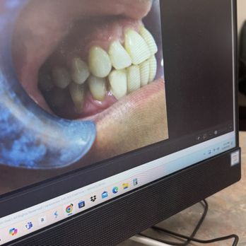 Meir Agaki, DDS - Before - Cosmetic Dentists Near Me - Los Angeles, California Meir Agaki, DDS - Before - Cosmetic Dentists Near Me - Los Angeles, California