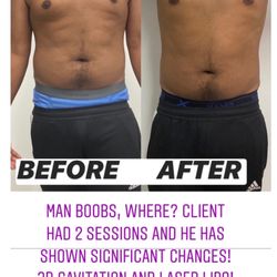 Sculpt N’ Bronze Studio - Cavitation treatment!