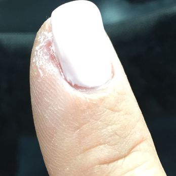 Aloha Nail - Skin is so dry & raw after. - Nail Salons Near Me - Las Vegas, Nevada Aloha Nail - Skin is so dry & raw after. - Nail Salons Near Me - Las Vegas, Nevada