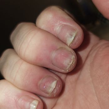 Pamper Me Nails & Spa - Nails fungus. My nails are destroyed - Nail Salons Near Me - Hesperia, California