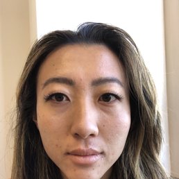 Day 1 skin: Pre-Caren. Large Undereye bags, Dull flaky skin, lots of breakouts Day 1 skin: Pre-Caren. Large Undereye bags, Dull flaky skin, lots of breakouts