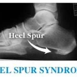 San Francisco Foot & Ankle Group - Prescription Orthotics (Cost Effective Treatment)