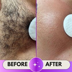Steffi Loeffler Esthetics - Brazilian Wax
