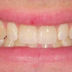 Sheila L. Brush, DDS | Dentist in Germantown, Maryland - Sheila L. Brush, DDS | Dentist in Germantown, MD 19873 Century Blvd, Suite 210  Germantown, MD 20874 http://www.weloveyoursmi...