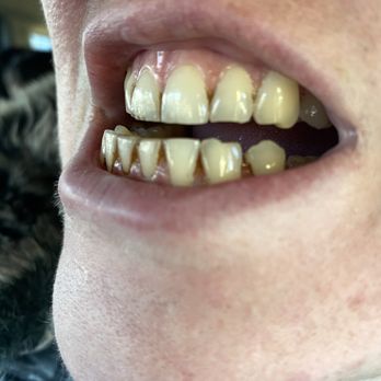Aspen Dental - Taylors, SC - General Dentistry Near Me - Taylors, South Carolina