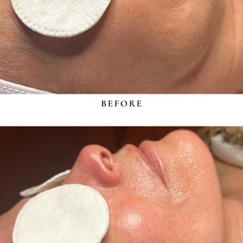 Identity skin spa - Facial Sculpting - Massage Near Me - Canfield , Ohio