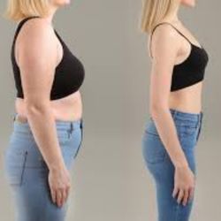 California Medical Group - Before and after treatment