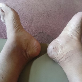 Sexy Nails - A closer angle of my feet after the pedicure. - Nail Salons Near Me - Albany, Georgia Sexy Nails - A closer angle of my feet after the pedicure. - Nail Salons Near Me - Albany, Georgia