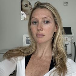 Novaskin Med Spa & Laser Center
