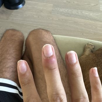 Classy Nail Polish - Nail swelling - Nail Salons Near Me - Tustin, California