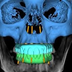Lakeshore Oral & Maxillofacial Surgery