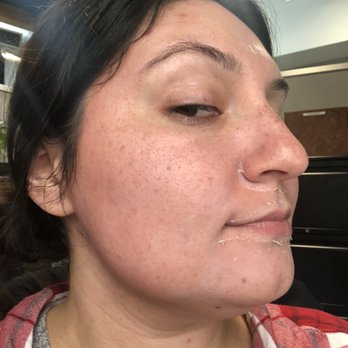 Sanctuary Spa - Day 3 - Skin Care Near Me - Long Beach, California